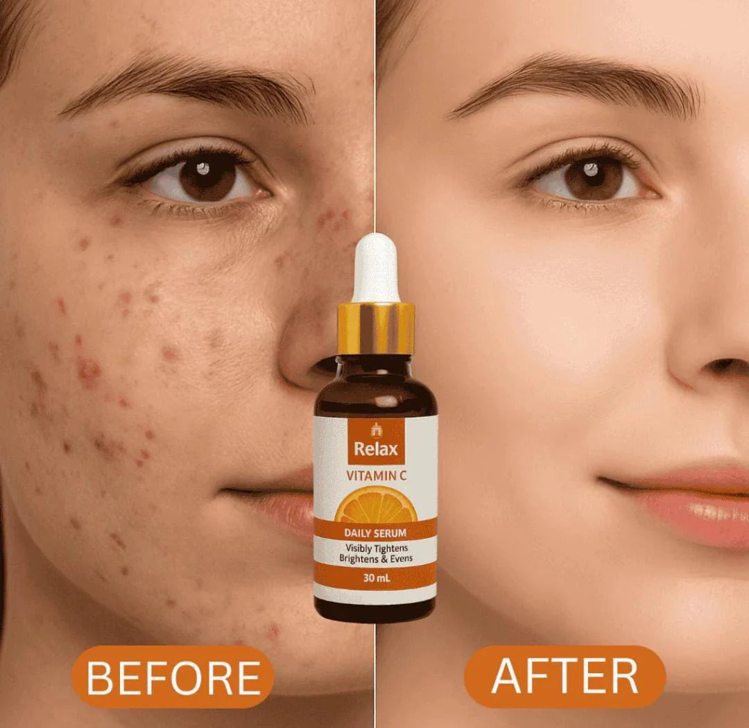 Relax Vitamin C Face Serum – Daily Brightening, Hydrating & Anti-Aging Care for Smooth, Glowing Skin (30ml)