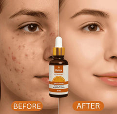 Relax Vitamin C Face Serum – Daily Brightening, Hydrating & Anti-Aging Care for Smooth, Glowing Skin (30ml)